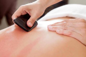 gua sha eden park acupuncture